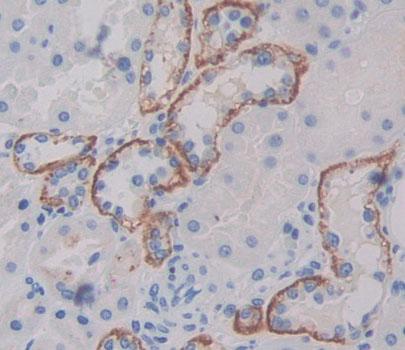 阿米洛利敏感钠离子通道蛋白1γ(SCNN1g)多克隆抗体