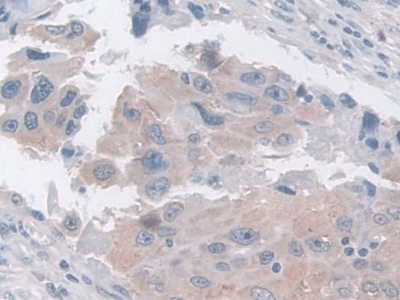 乳腺絲抑蛋白(Maspin)多克隆抗體