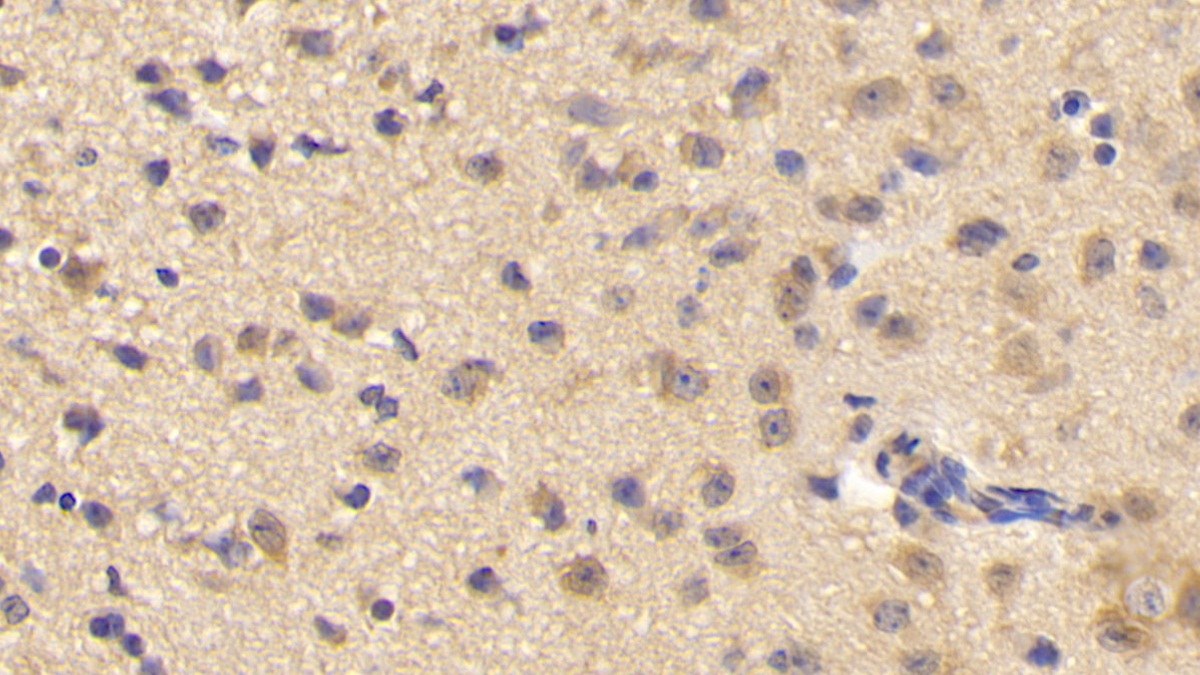 磷酯酶Cδ1(PLCd1)多克隆抗体