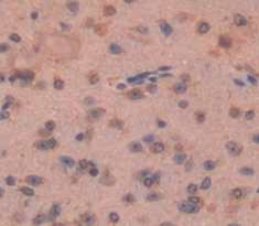 卷曲同源物1(FZD1)多克隆抗體