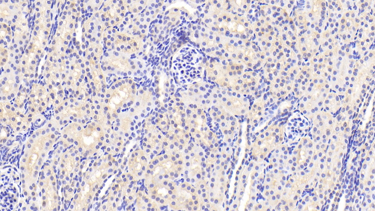 膜聯(lián)蛋白A3(ANXA3)多克隆抗體