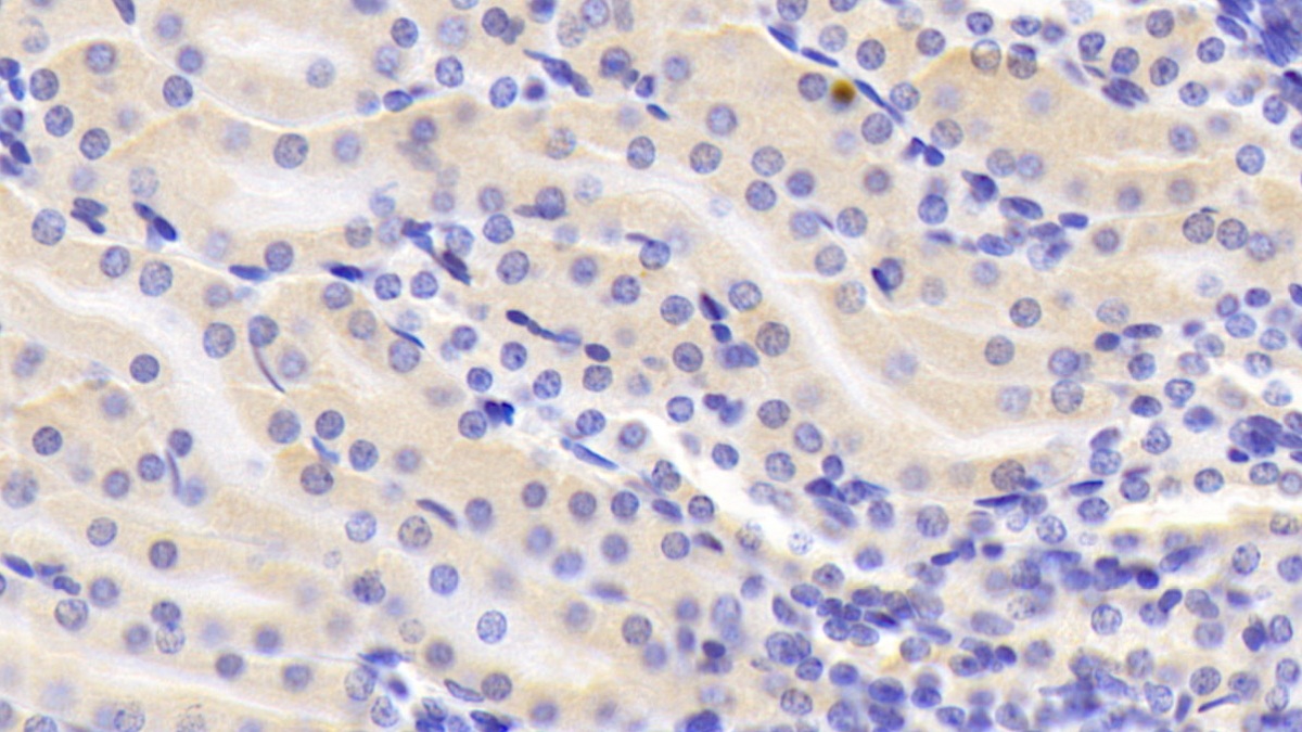 膜聯(lián)蛋白A3(ANXA3)多克隆抗體