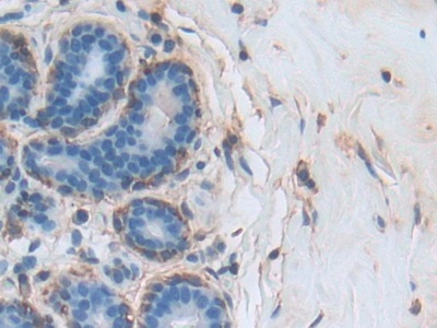 膜聯(lián)蛋白A3(ANXA3)多克隆抗體