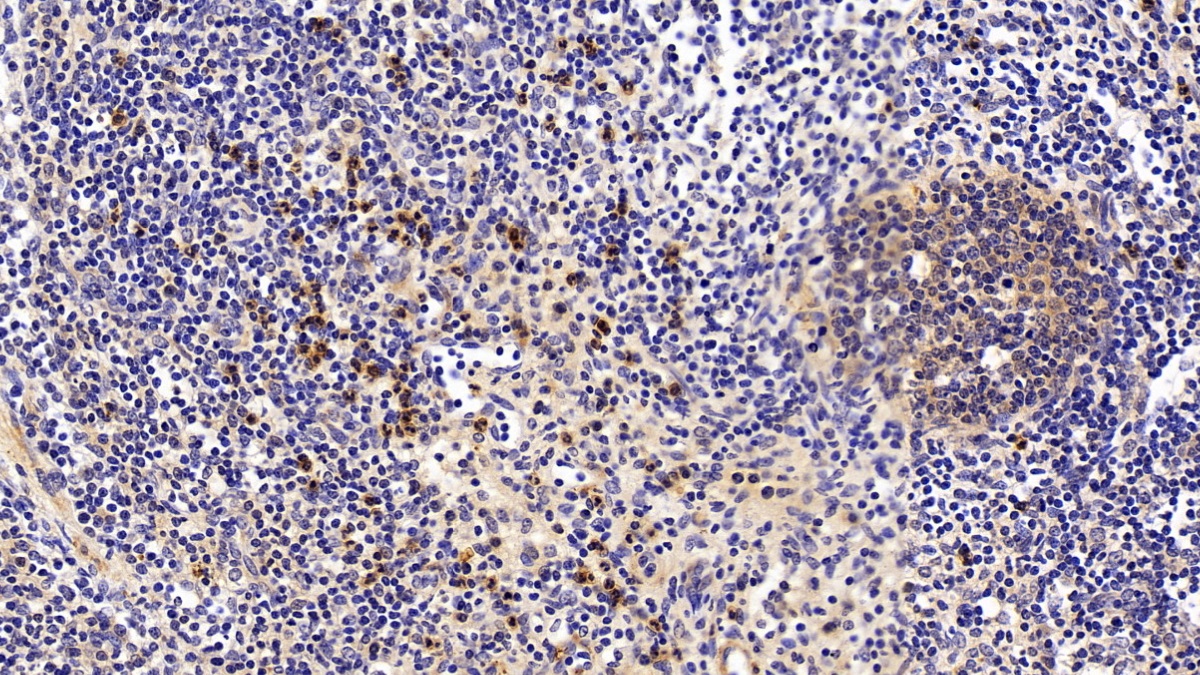 膜聯(lián)蛋白A1(ANXA1)多克隆抗體