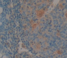 白介素1ε(IL1e)多克隆抗体