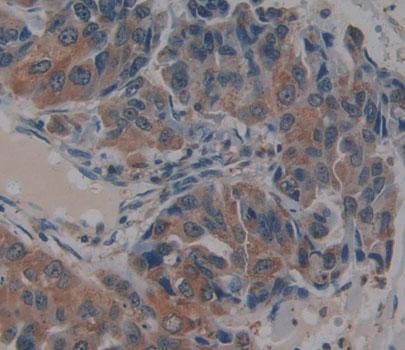 Bcl2關(guān)聯(lián)永生基因5(BAG5)多克隆抗體