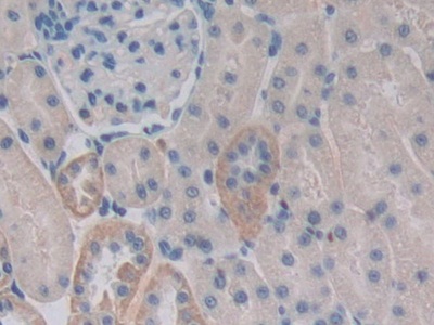 矢车菊苷α2(CENTa2)多克隆抗体