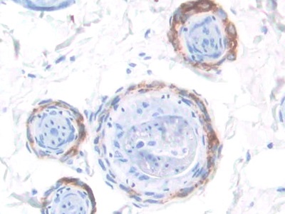T-框蛋白3(TBX3)多克隆抗體