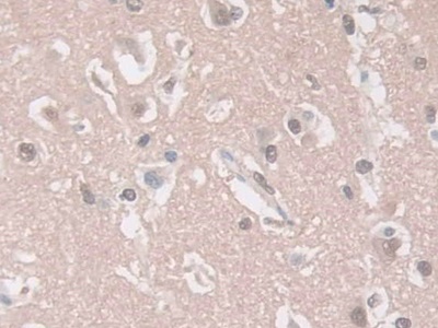 鸟苷酸环化酶1β3(GUCY1b3)多克隆抗体
