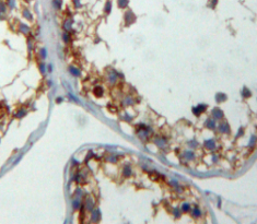 Glu/Asp丰富羧基端域Cbp/p300相互作用反式激活因子1(CITED1)多克隆抗体