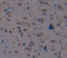 肺癌衍生V-Myc骨髓細(xì)胞瘤病毒癌基因同源物1(MYCL1)多克隆抗體