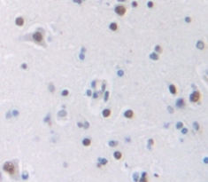 轉(zhuǎn)化因子2β(TRA2b)多克隆抗體