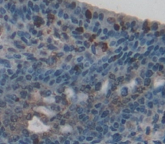 Reprimo蛋白(RPRM)多克隆抗體