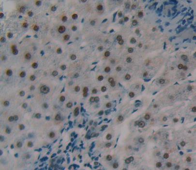 含BRCA1/BRCA2复合体3亚基(BRCC3)多克隆抗体