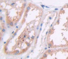 细胞分裂周期因子25B(CDC25B)多克隆抗体