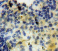 血管内皮生长因子145(VEGF145)多克隆抗体