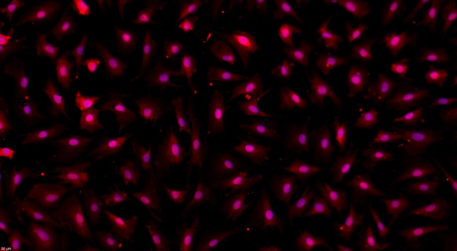 兔心脏微血管内皮细胞(CMEC)原代细胞