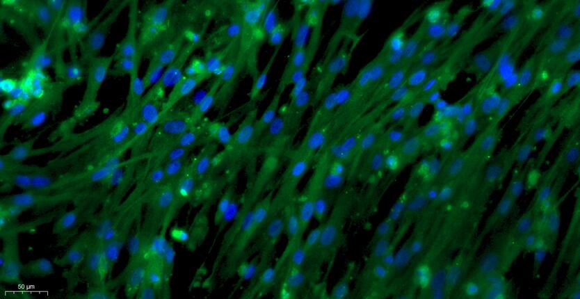 大鼠主动脉内皮细胞(AEC)原代细胞