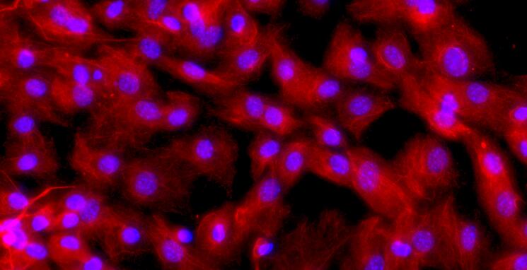 小鼠肺微血管内皮细胞(PMEC)原代细胞