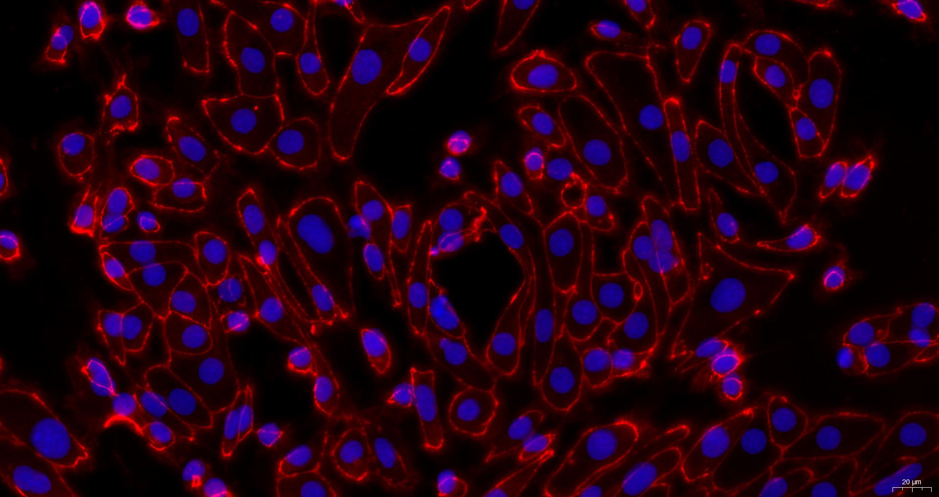 小鼠肾皮质上皮细胞(RCEC)原代细胞