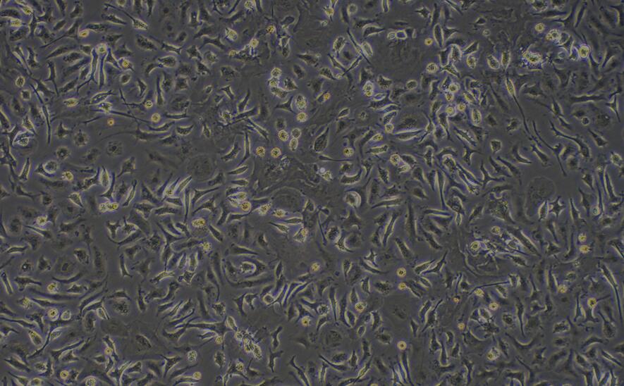 小鼠肝星形细胞(HSC)原代细胞