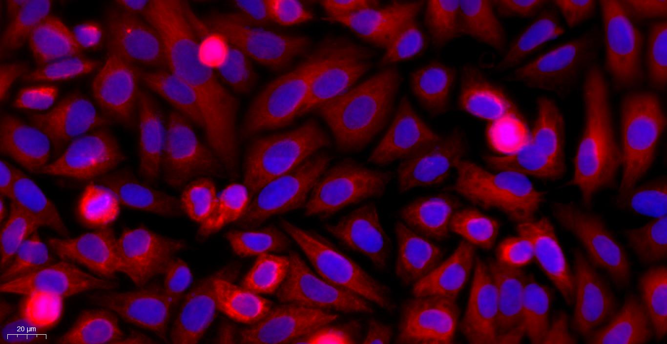 小鼠新生儿表皮角质形成细胞(NEK)原代细胞