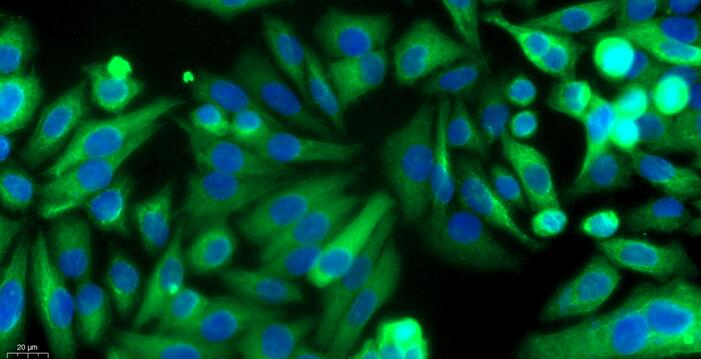 兔新生儿表皮角质形成细胞(NEK)原代细胞