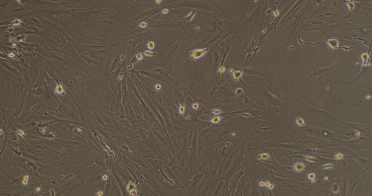 小鼠心肌成纤维细胞(CF)原代细胞