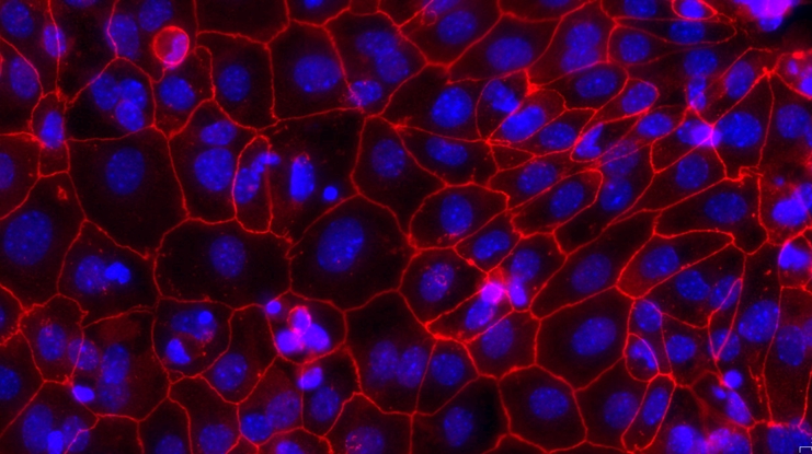 小鼠宫颈上皮细胞(CrEC)原代细胞
