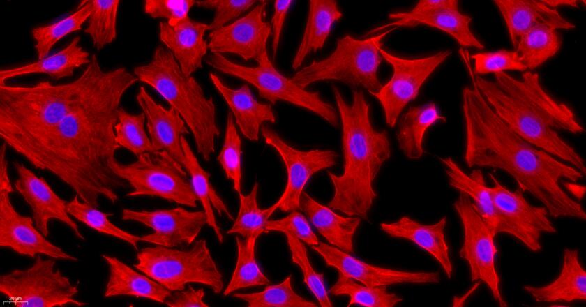 山羊髓核细胞(NPC)原代细胞
