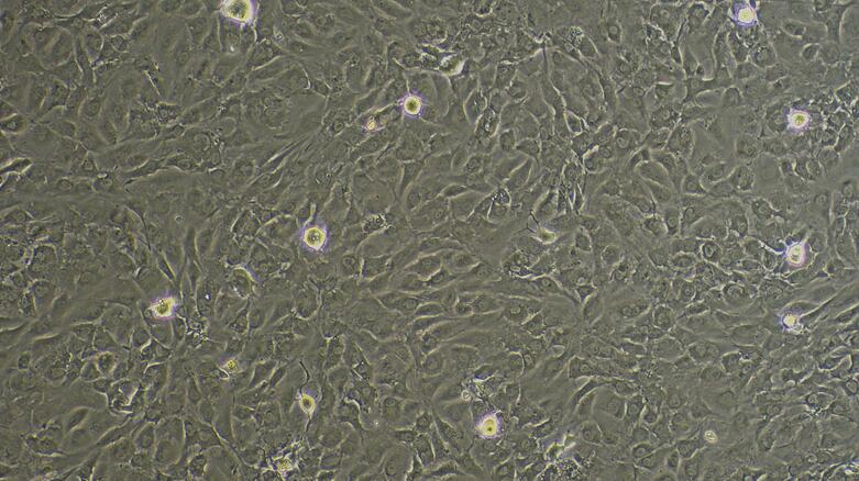小鼠脂肪微血管内皮细胞(AMEC)原代细胞