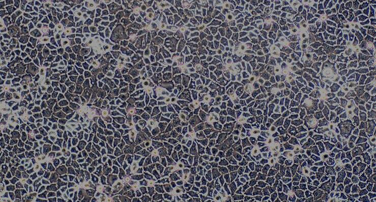 人结直肠腺癌细胞（CaCo-2）