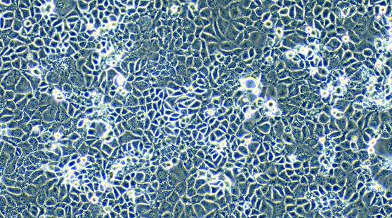 人肝癌细胞（Hep3B）