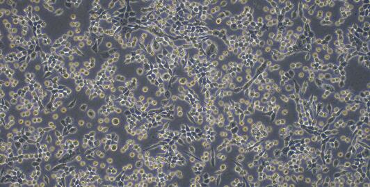 小鼠刘易斯肺癌细胞(LLC)