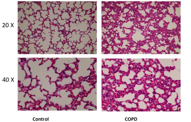 慢性阻塞性肺病(COPD)小鼠模型