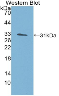 PAA423Hu01.jpg