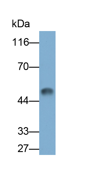 PAA534Ra01.jpg
