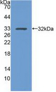 PAB313Hu01.jpg