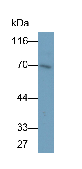 PAB393Hu01.jpg