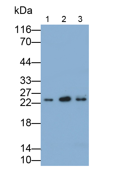 PAC869Hu01.jpg