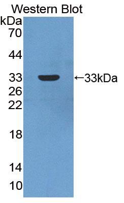 PAD081Hu01.jpg