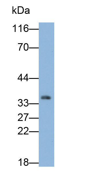 PAG491Hu01.jpg