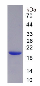 RPA632Hu01.jpg