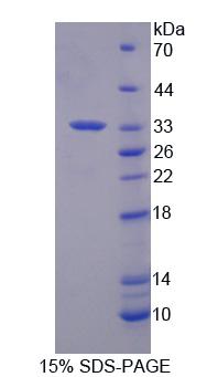 RPC175Hu01.jpg
