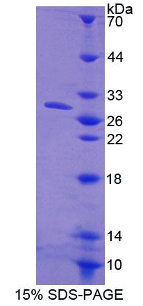 RPE031Hu01.jpg