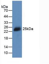 白介素2(IL2)活性蛋白