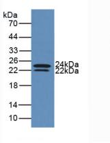 白介素6(IL6)活性蛋白