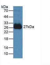 白介素6(IL6)活性蛋白