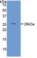 白介素6(IL6)活性蛋白