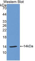 巨噬细胞炎性蛋白1α(MIP1a)活性蛋白